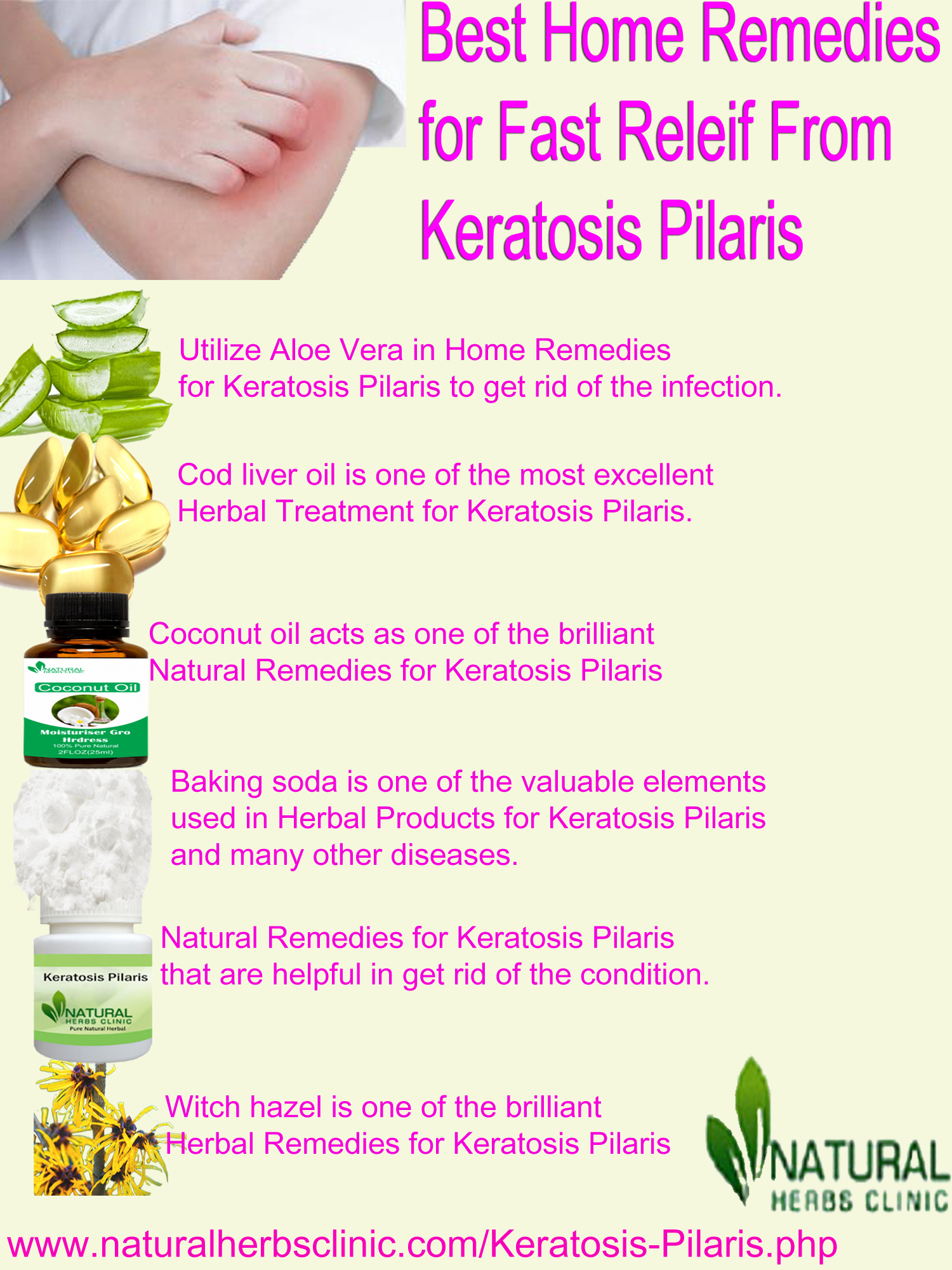 keratosis pilaris natural treatment Archives - Natural Herbs Clinic - Blog