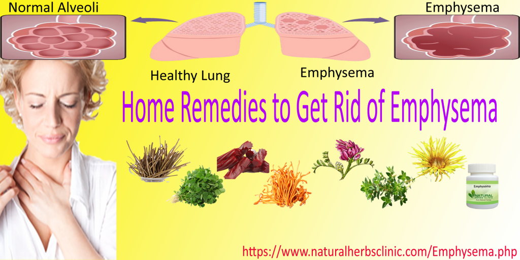 Natural Home Remedies for Emphysema