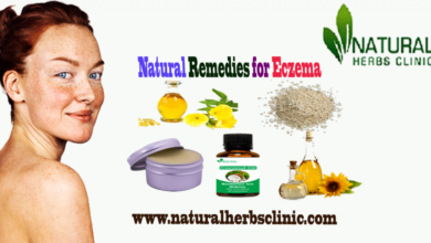 Natural-Remedies-for-Eczema-1024x555