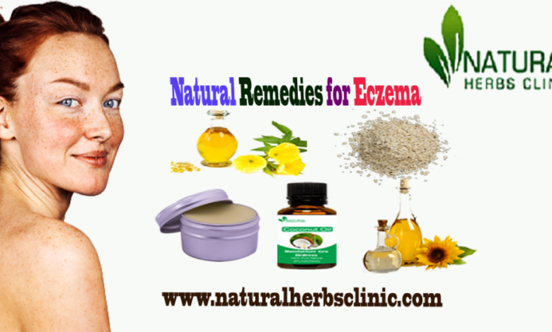 Natural-Remedies-for-Eczema-1024x555