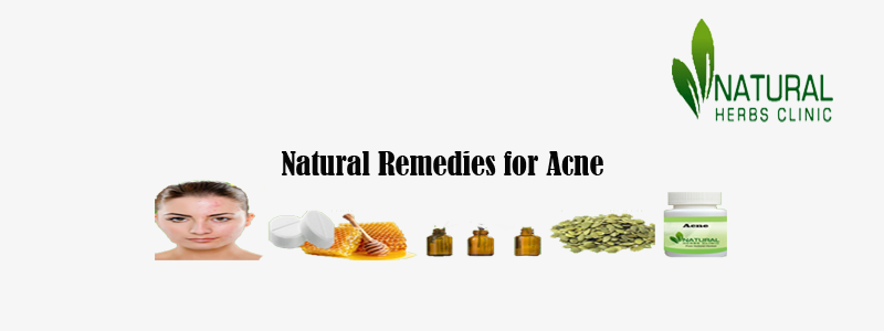 Natural Remedies for Acne Natural Remedies for Acne