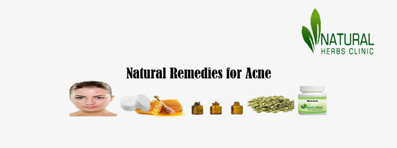 Natural Remedies for Acne