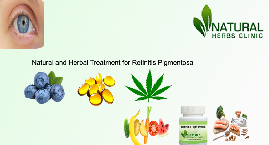 Herbal Treatment for Retinitis Pigmentosa