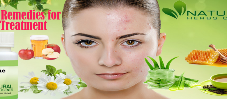 Natural-Remedies-for-Acne-Complete-Natural-Treatment-1024x341