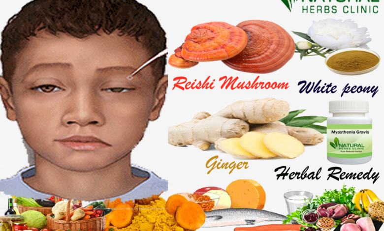 Natural-and-Herbal-Treatment-for-Myasthenia-Gravis