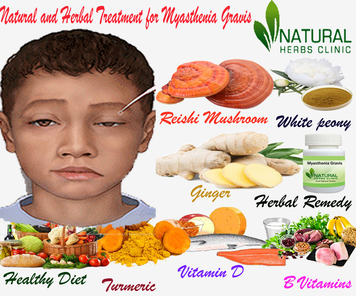Natural and Herbal Treatment for Myasthenia Gravis