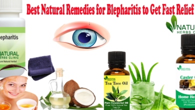 Natural Cure For Blepharitis 10 Proven Remedies You Need To Try Today Natural Cure For Blepharitis 10 Proven Remedies You Need To Try Today