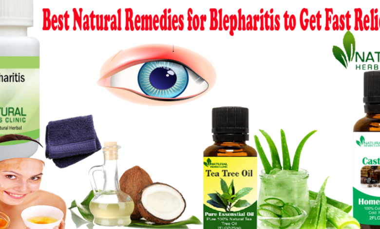 Best-Natural-Remedies-for-Blepharitis-to-Get-Fast-Relief-1024x512