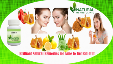 Natural-Remedies-for-Acne-1024x585