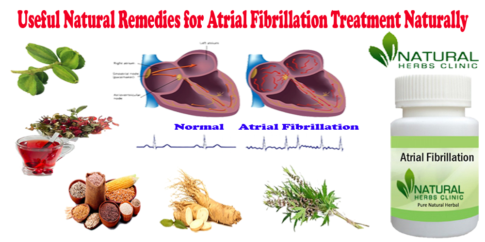 Useful Natural Remedies for Atrial Fibrillation Treatment Naturally