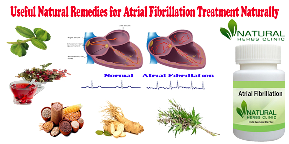 Natural Remedies for Atrial Fibrillation