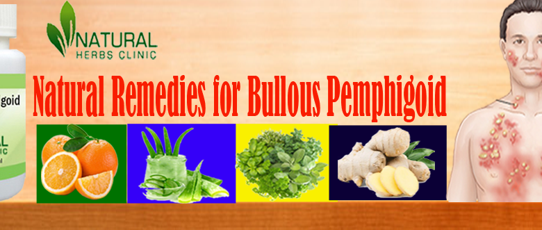 Natural-Remedies-for-Bullous-Pemphigoid