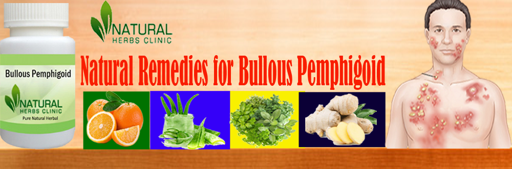 Natural Remedies for Bullous Pemphigoid