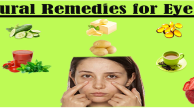 Natural-Remedies-for-Eye-Bags-1