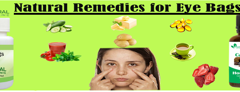 Natural-Remedies-for-Eye-Bags-1