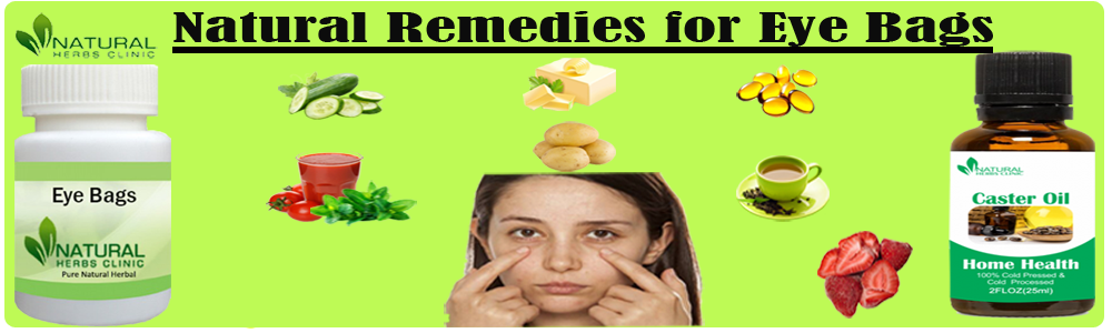 Natural Remedies for Eye Bags