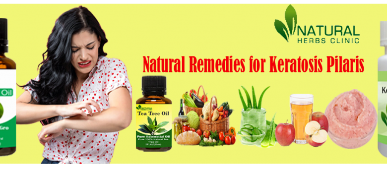 Natural-Remedies-for-Keratosis-Pilaris-1-1024x341