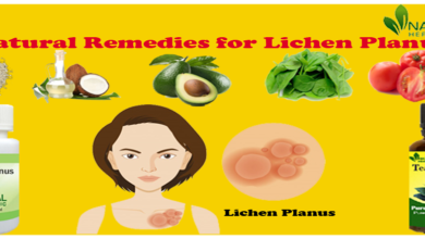 Natural-Remedies-for-Lichen-Planus-1