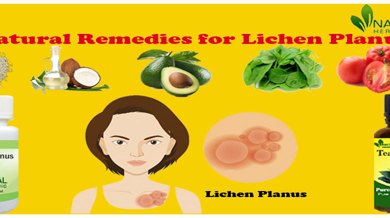 Natural-Remedies-for-Lichen-Planus-1