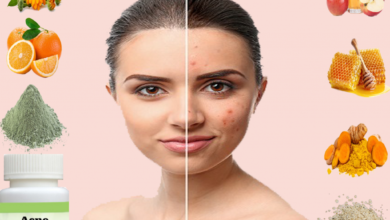 Proven-Natural-Remedies-for-Acne-1024x853