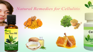 Natural-Remedies-for-Cellulitis-1