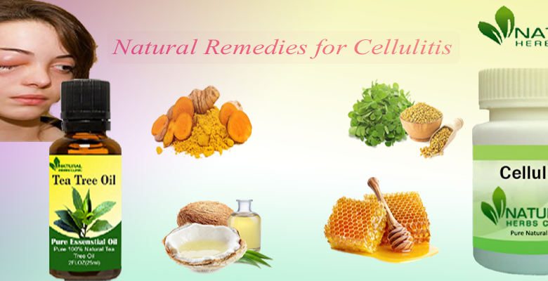 Natural-Remedies-for-Cellulitis-1