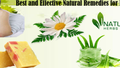 Natural-Remedies-for-Eczema