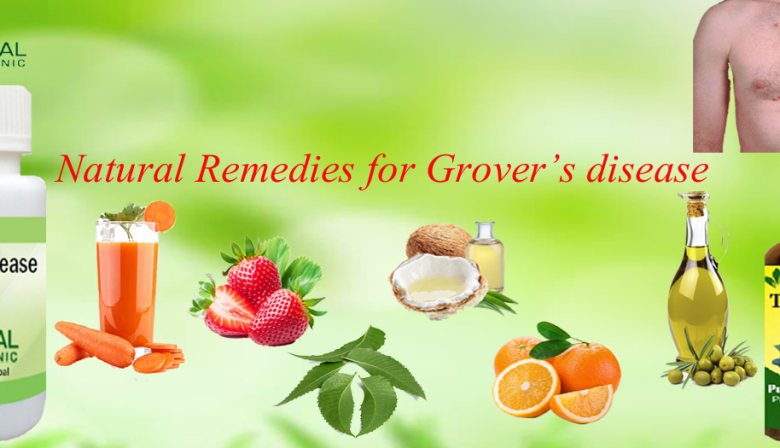 Natural-Remedies-for-Grover’s-disease-1024x448