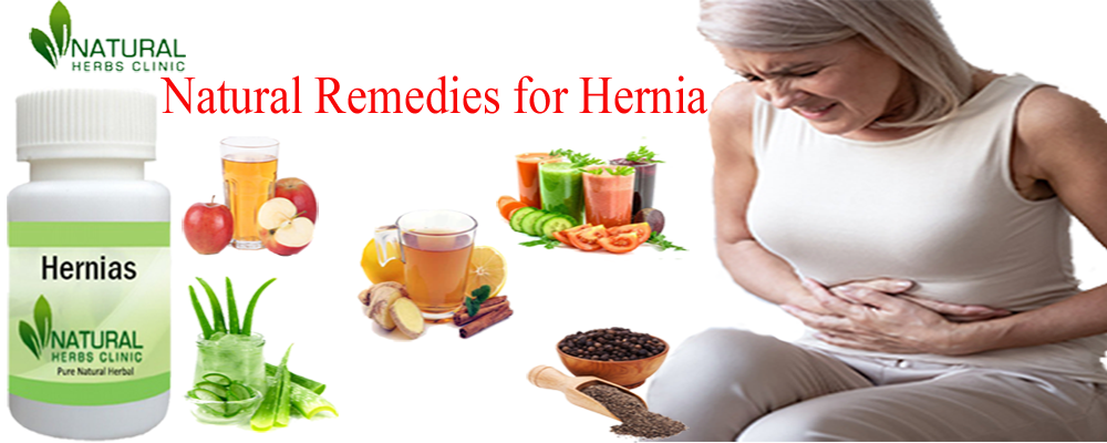 Natural Remedies for Hernia