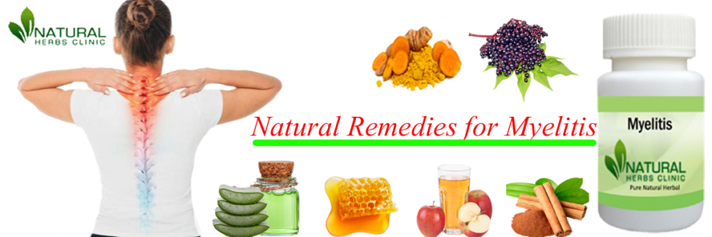 Natural Remedies for Myelitis Natural Remedies for Myelitis