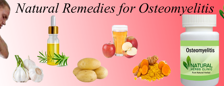 Natural-Remedies-for-Osteomyelitis