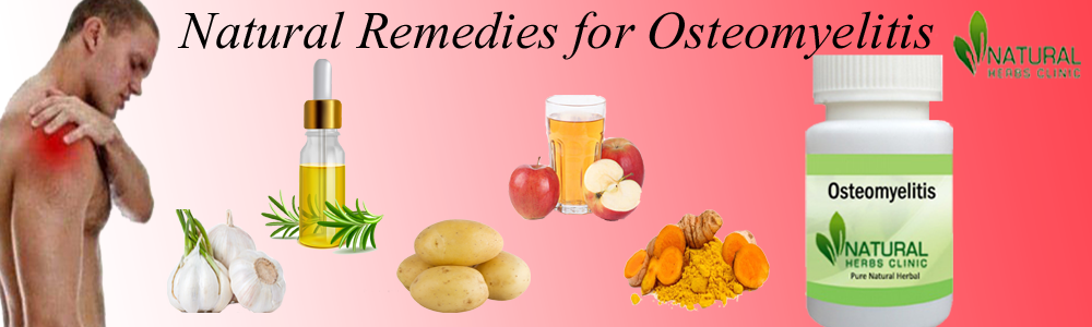 Natural Remedies for Osteomyelitis