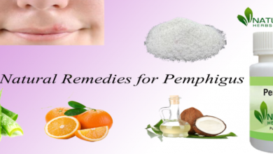 Natural-Remedies-for-Pemphigus-1024x427