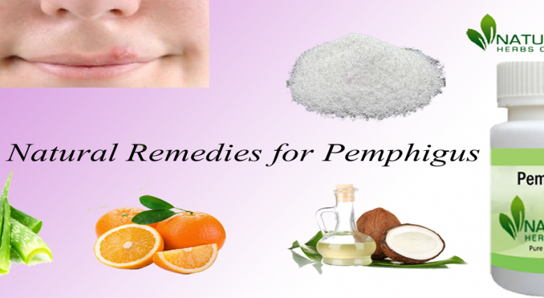 Natural-Remedies-for-Pemphigus-1024x427