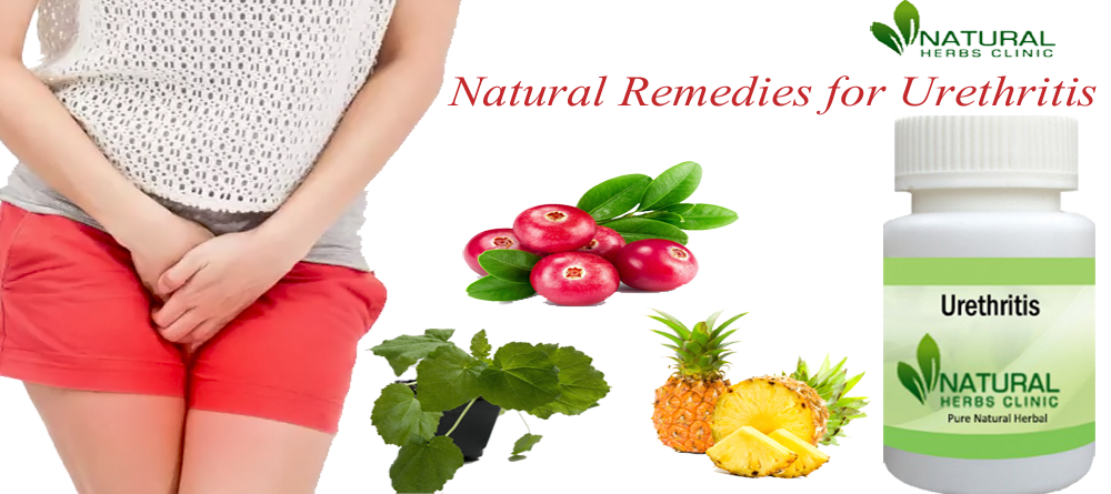 Natural Remedies for Urethritis