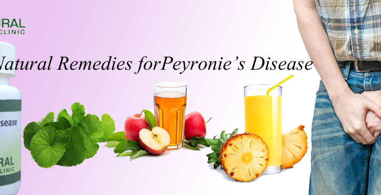 Natural-Remedies-forPeyronie’s-Disease