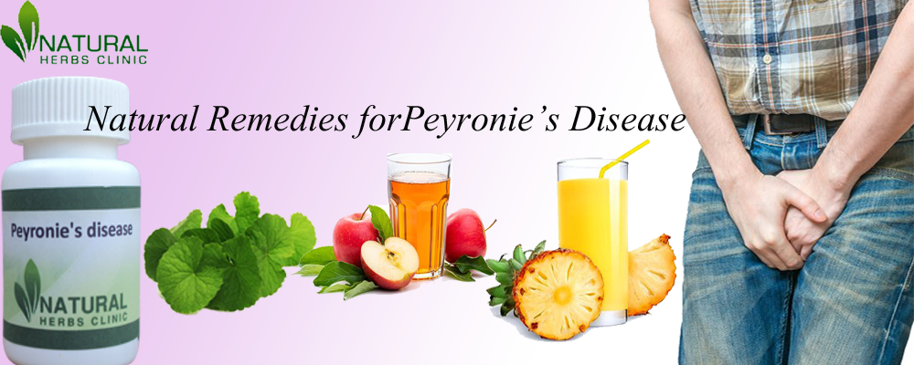 Natural Remedies for Peyronie’s Disease
