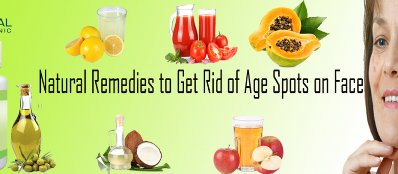 Natural-Remedies-to-Get-Rid-of-Age-Spots-on-Face-1024x341