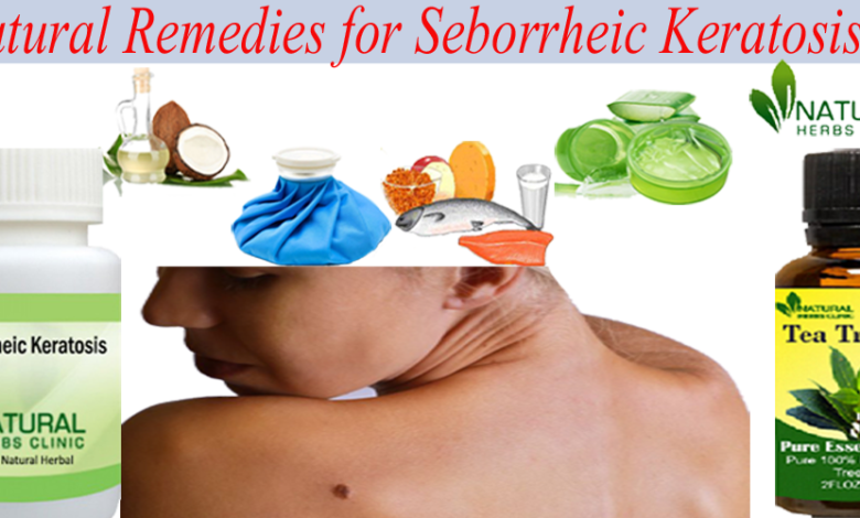Natural-remedies-for-seborrheic-keratosis
