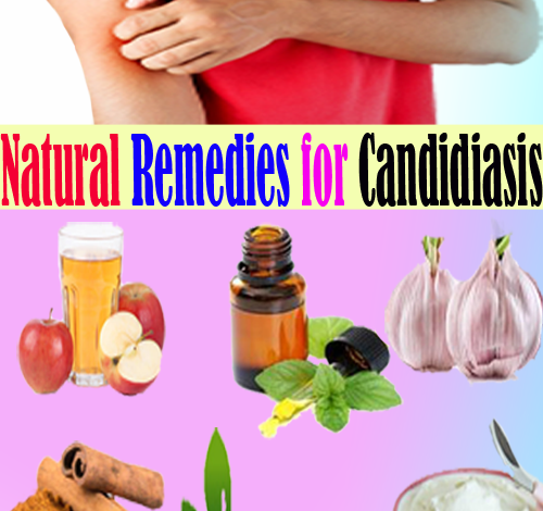 Remedies-for-Candidiasis