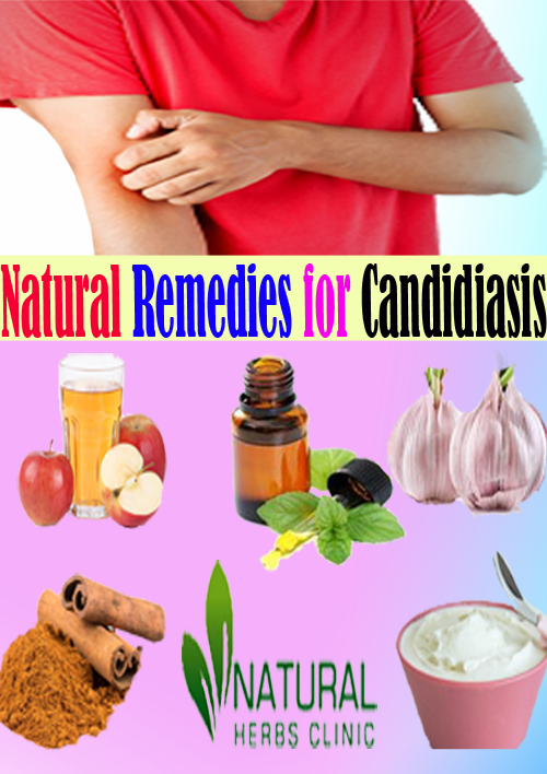Natural Remedies for Candidiasis