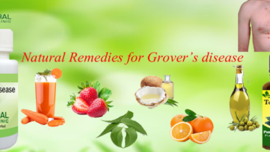 Remedies-for-Grover’s-disease-1024x448