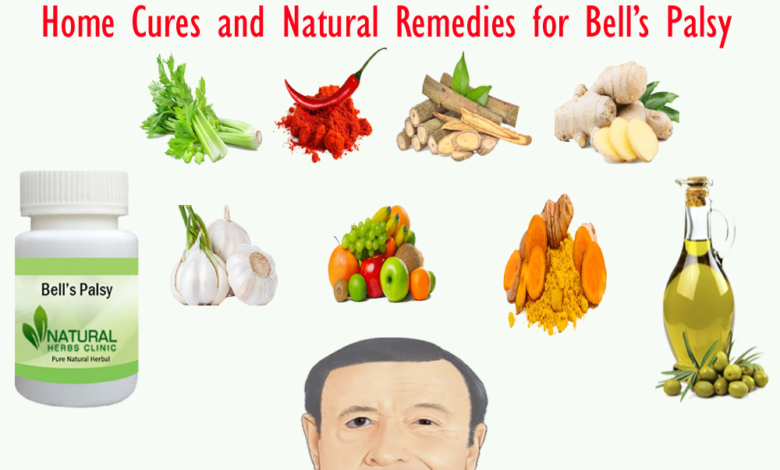 Home-Cures-and-Natural-Remedies-for-Bell’s-Palsy