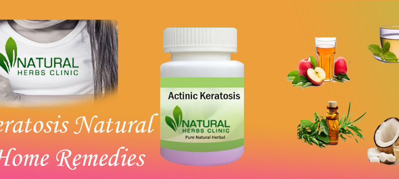 Actinic-Keratosis-Natural-Cure-and-Home-Remedies