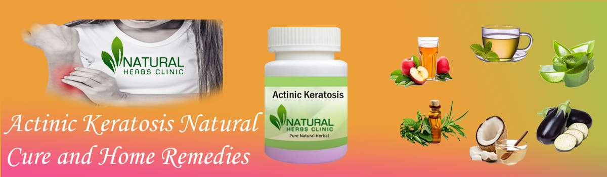 Natural Remedies for Actinic Keratosis