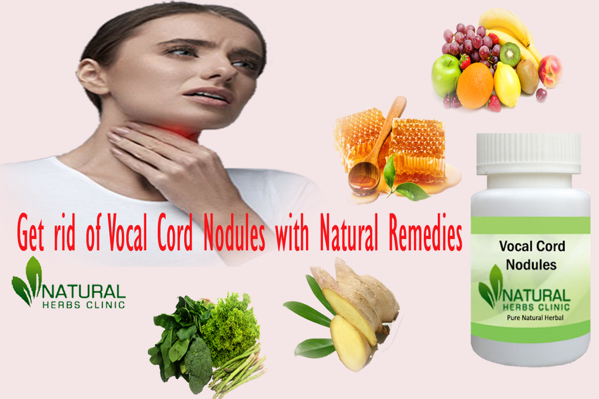 Get rid of Vocal Cord Nodules with Natural Remedies