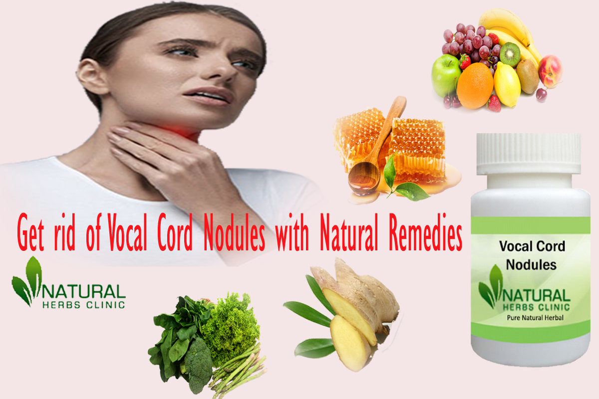 Natural Remedies for Vocal Cord Nodules