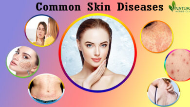 Herbal-Products-for-Skin-Diseases-1