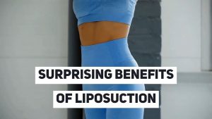 benefits-of-liposuction-surgery-300x169