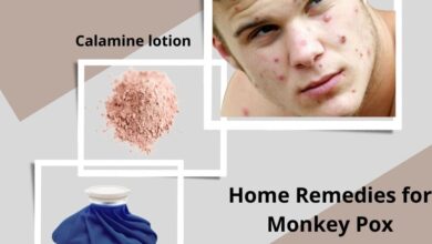 Home-Remedies-for-Monkey-Pox